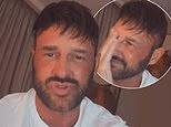 Katie Price’s husband Lee Andrews blames prison food for hair transformation