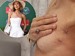 Myleene Klass reveals 'terrifying' breast cancer scare after finding lump during Wimbledon