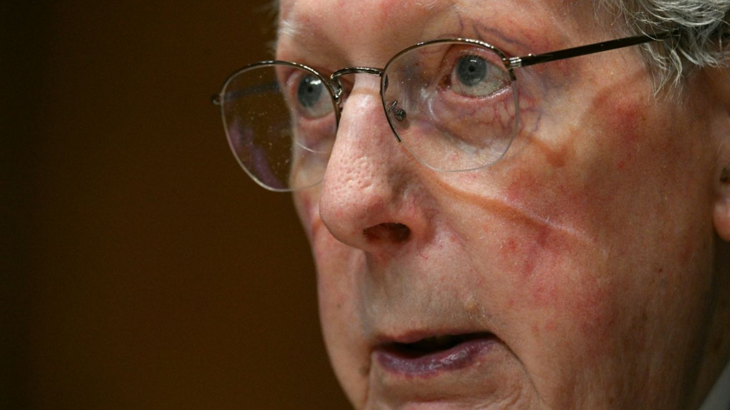 Fall and “mild” pneumonia: Mitch McConnell comments on hospital stay