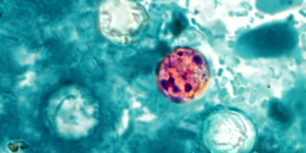 Lettuce or salad greens could be source of diarrhea-causing illness, Michigan health officials say