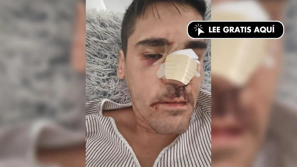 Le journaliste Fonsi Loaiza dénonce une paliza dans la rue : -Ils m'ont appelé "rojo, sous-champion
