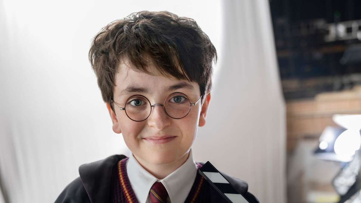 La serie "Harry Potter" cambia la cicatriz relámpago: Este detalle es inmediatamente notable