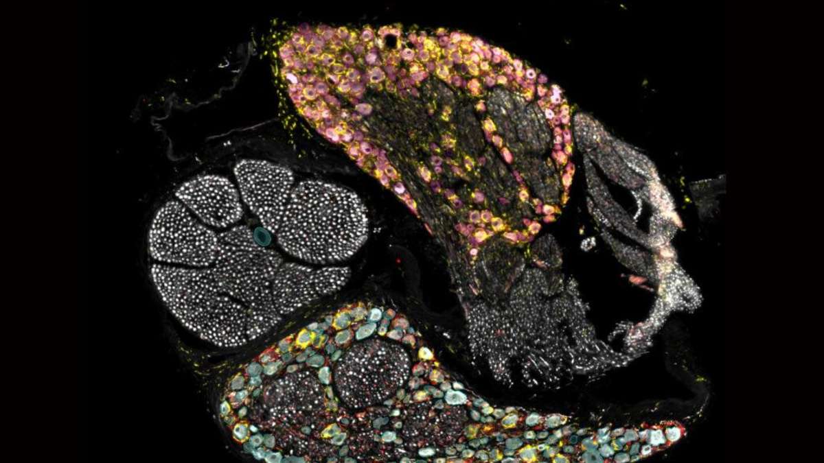 How Pain Is Processed by Men and Women: Study Shows Surprising Difference