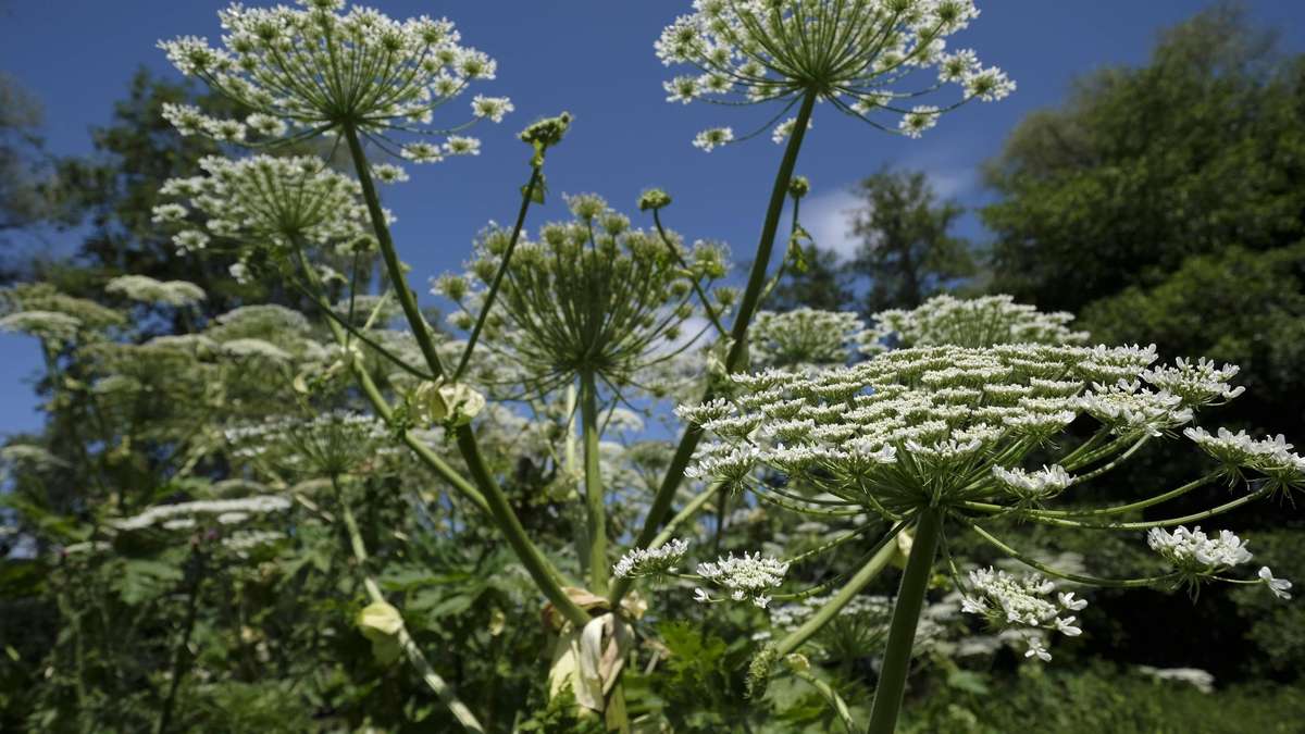 Beware of gardening: Some plants trigger painful blisters